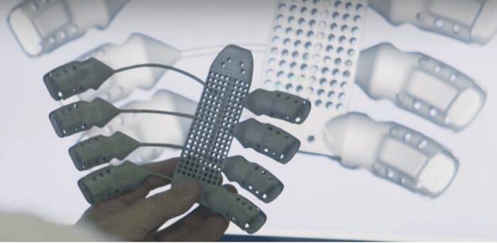 3D Printed Metal Ribs For Cancer Patient